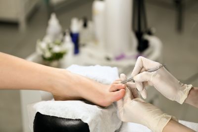 Medicinska pedikura stopala pri strokovno usposobljeni pedikerki